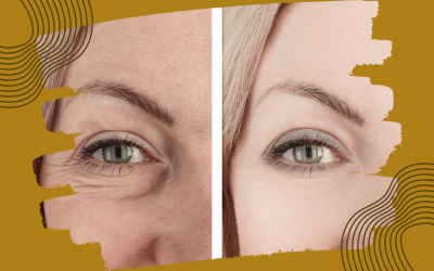 Sguardo giovane senza Chirurgia