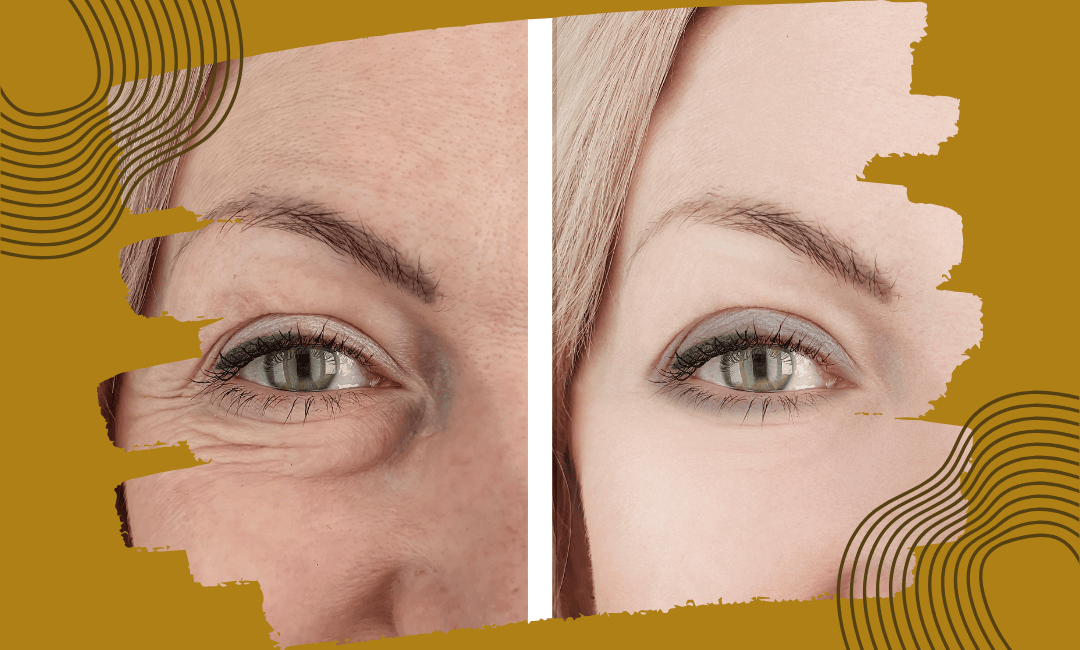 Sguardo giovane senza Chirurgia